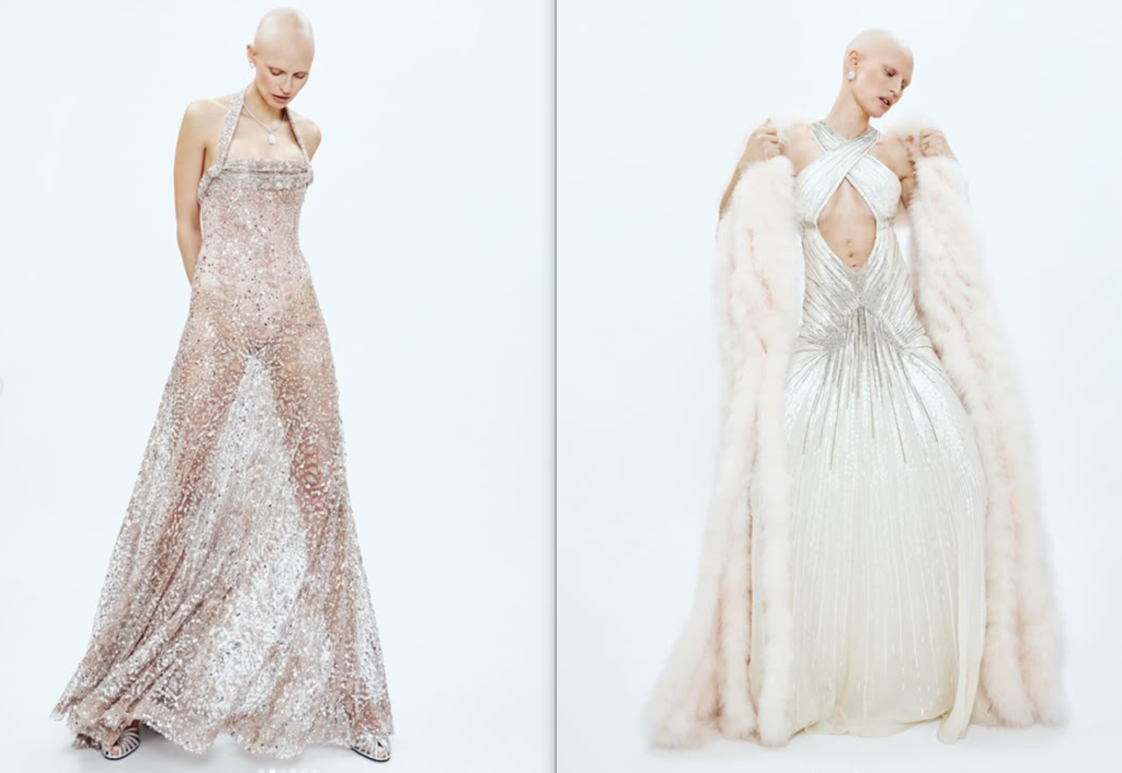 Bianca Balti: una lezione di professionalità e coraggio