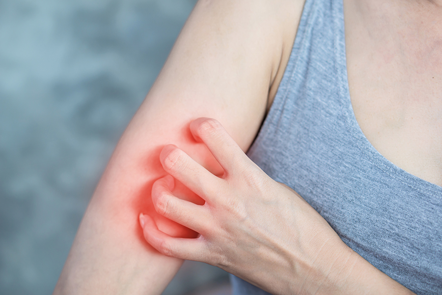 Allergie e sport in primavera: guida pratica per allenarsi senza rischi