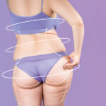 Una guida completa per contrastare la cellulite: i primi risultati in poche settimane Una guida completa per contrastare la cellulite: i primi risultati in poche settimane
